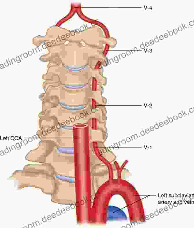 Brain Stroke Extracranial Carotid And Vertebral Artery Disease: Contemporary Management