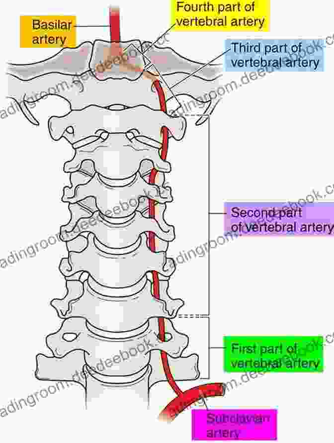 Vertebral Artery Extracranial Carotid And Vertebral Artery Disease: Contemporary Management