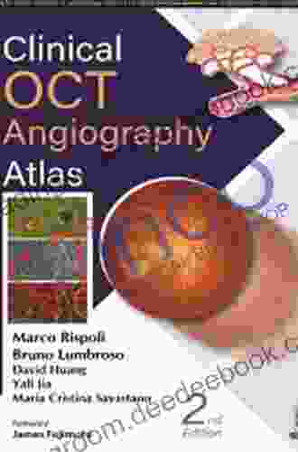 Clinical OCT Angiography Atlas Anthony Gibson